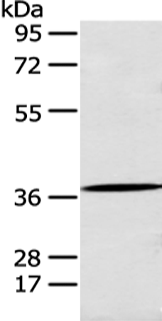 Anti-Annexin A10 Rabbit Polyclonal Antibody