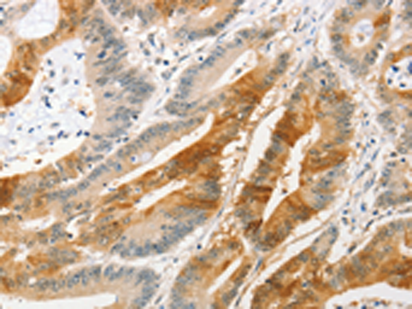 Anti-ANAPC2 Rabbit Polyclonal Antibody
