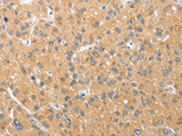 Anti-ANAPC5 Rabbit Polyclonal Antibody