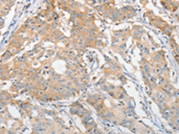 Anti-ApoBEC3G Rabbit Polyclonal Antibody