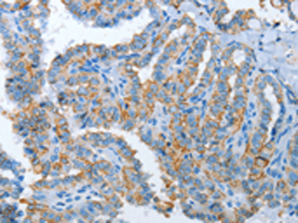 Anti-ASL Rabbit Polyclonal Antibody
