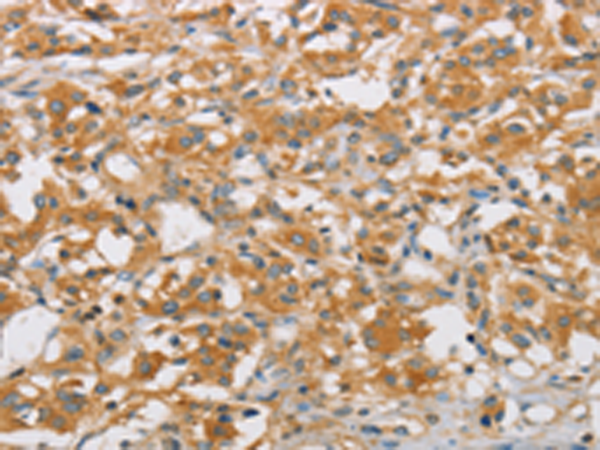 Anti-ARHGEF7 Rabbit Polyclonal Antibody