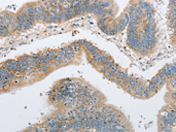 Anti-ARHGEF9 Rabbit Polyclonal Antibody
