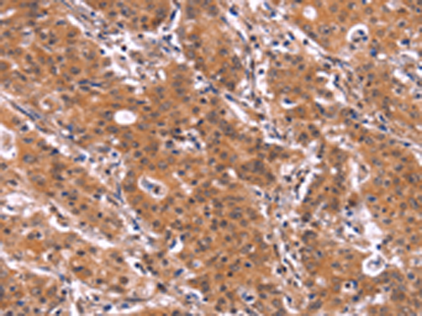Anti-ARL4A Rabbit Polyclonal Antibody