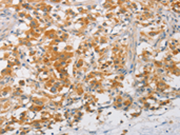 Anti-ARMCX3 Rabbit Polyclonal Antibody