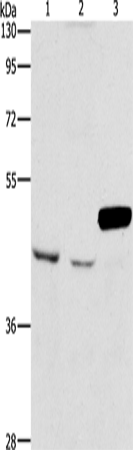 Anti-ARMCX3 Rabbit Polyclonal Antibody