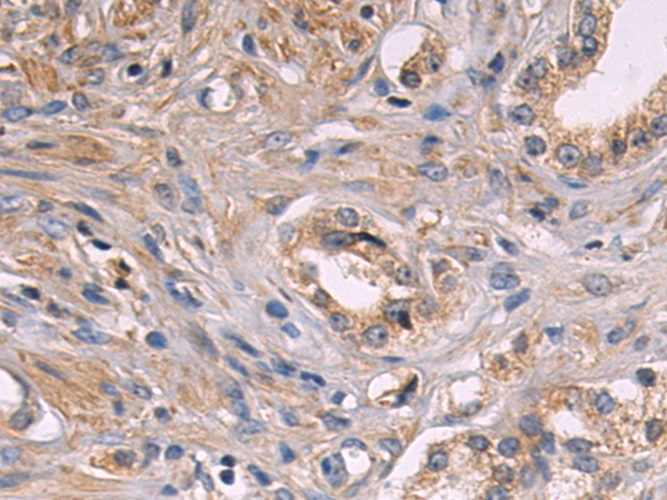 Anti-CD135 Rabbit Polyclonal Antibody