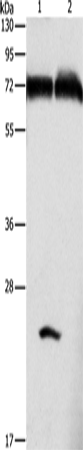 Anti-GDE2 Rabbit Polyclonal Antibody