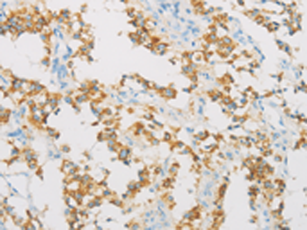 Anti-IDH3B Rabbit Polyclonal Antibody