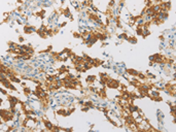 Anti-IDH3G Rabbit Polyclonal Antibody