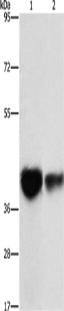 Anti-IDH3G Rabbit Polyclonal Antibody