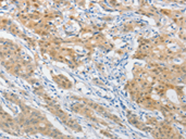 Anti-Hsp40 Rabbit Polyclonal Antibody