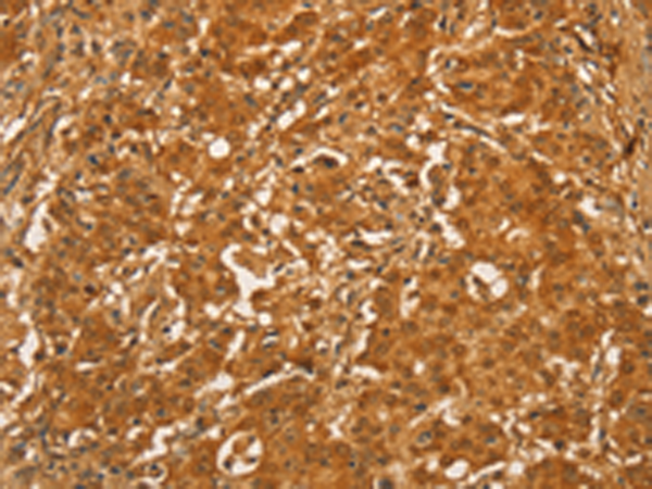 Anti-RPL26L1 Rabbit Polyclonal Antibody