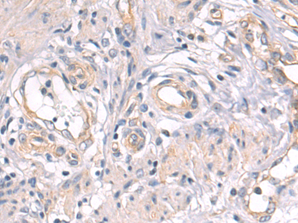 Anti-Ubiquilin 1 Rabbit Polyclonal Antibody
