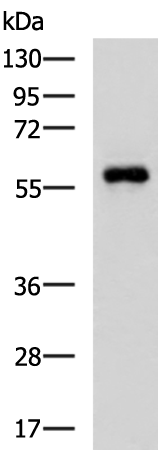 Anti-Ubiquilin 1 Rabbit Polyclonal Antibody
