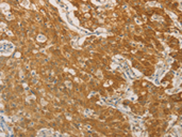 Anti-PSMB7 Rabbit Polyclonal Antibody