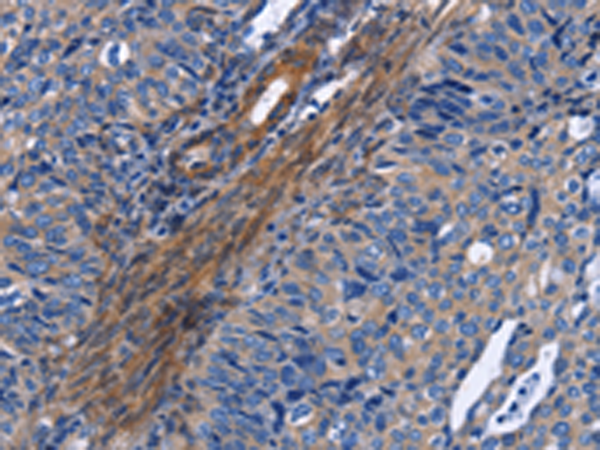 Anti-NAT8 Rabbit Polyclonal Antibody