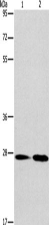 Anti-NAT8 Rabbit Polyclonal Antibody