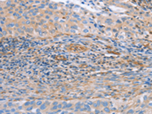 Anti-NRG4 Rabbit Polyclonal Antibody
