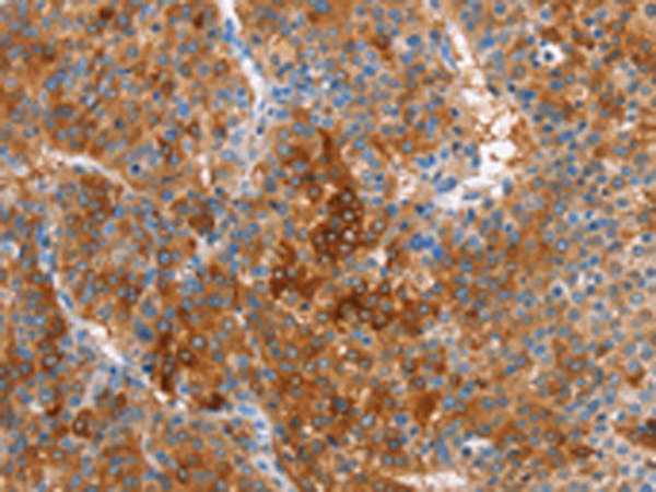 Anti-CBS Rabbit Polyclonal Antibody