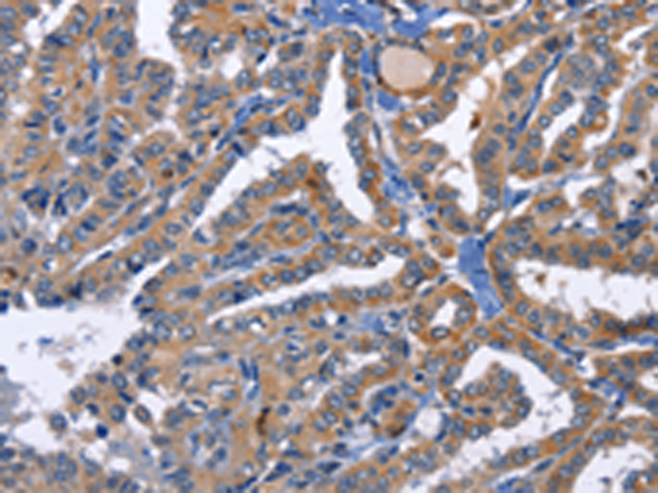 Anti-PKC delta Rabbit Polyclonal Antibody