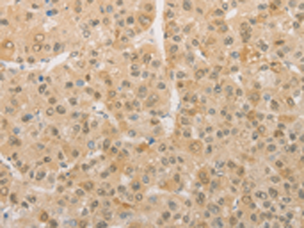 Anti-PGK2 Rabbit Polyclonal Antibody