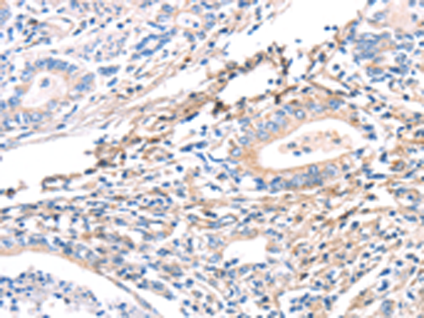 Anti-Twinfilin 2 Rabbit Polyclonal Antibody