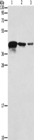 Anti-Twinfilin 2 Rabbit Polyclonal Antibody