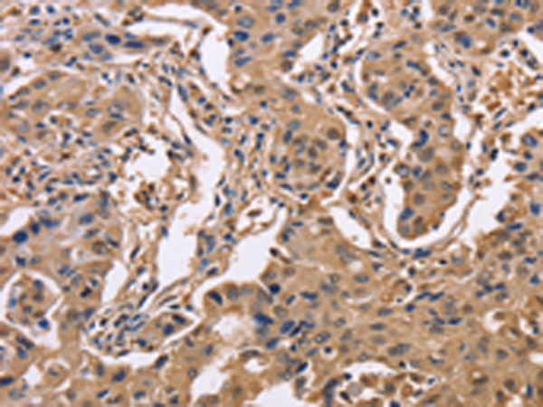 Anti-IDH1 Rabbit Polyclonal Antibody