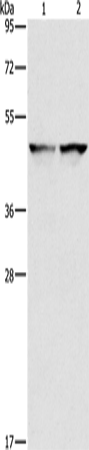 Anti-IDH1 Rabbit Polyclonal Antibody
