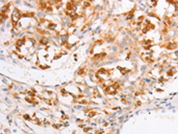 Anti-YARS2 Rabbit Polyclonal Antibody