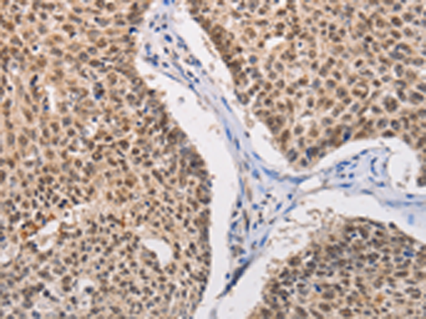 Anti-MYLK3 Rabbit Polyclonal Antibody
