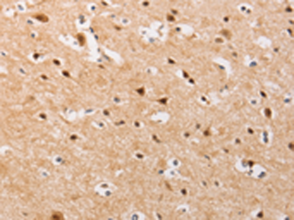 Anti-PIP5K1A Rabbit Polyclonal Antibody