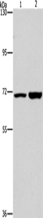 Anti-PIP5K1A Rabbit Polyclonal Antibody