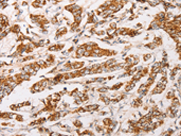 Anti-AK2 Rabbit Polyclonal Antibody