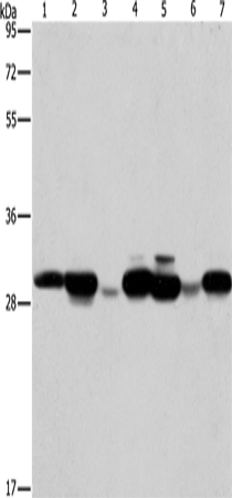 Anti-AK2 Rabbit Polyclonal Antibody