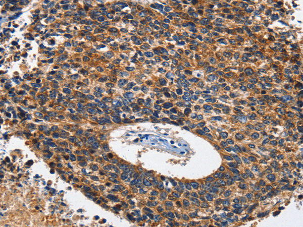 Anti-HK1/HK2 Rabbit Polyclonal Antibody