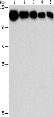 Anti-HK1/HK2 Rabbit Polyclonal Antibody