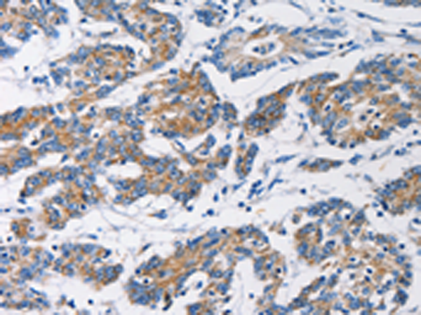 Anti-Hexokinase I Rabbit Polyclonal Antibody