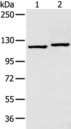 Anti-Hexokinase I Rabbit Polyclonal Antibody