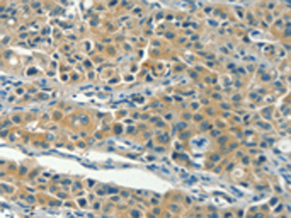 Anti-KLC1 Rabbit Polyclonal Antibody