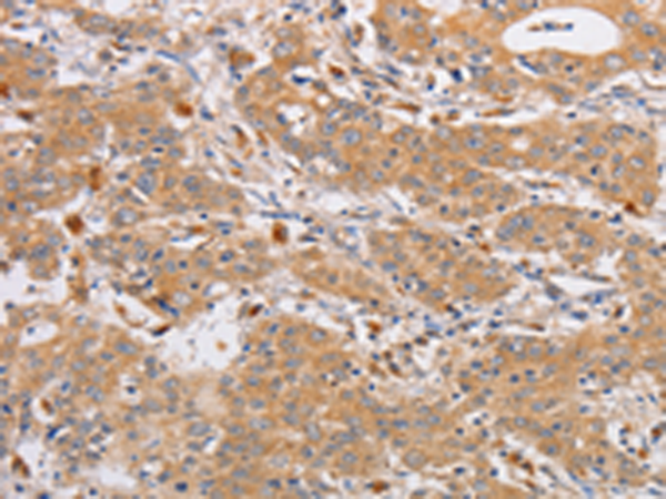 Anti-OLR1 Rabbit Polyclonal Antibody