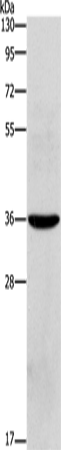 Anti-OLR1 Rabbit Polyclonal Antibody