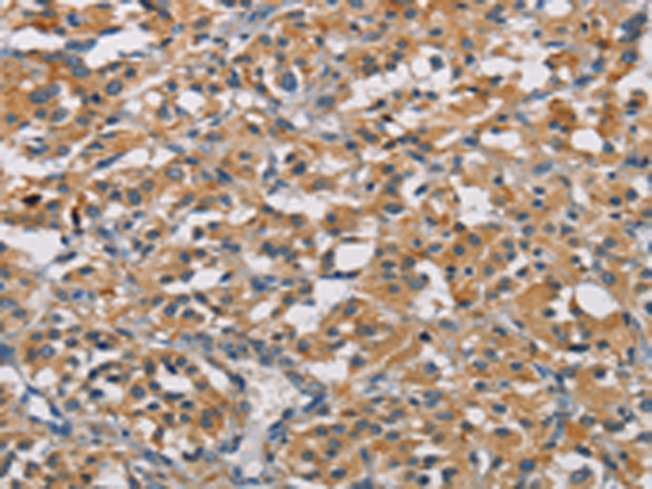 Anti-GPM6A Rabbit Polyclonal Antibody