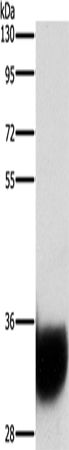 Anti-GPM6A Rabbit Polyclonal Antibody