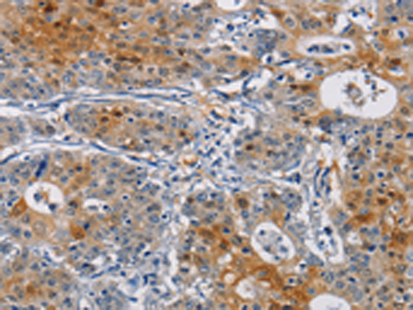 Anti-GSTA2 Rabbit Polyclonal Antibody