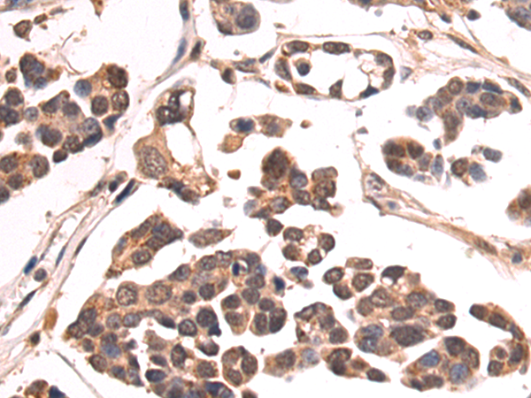 Anti-BAP1 Rabbit Polyclonal Antibody