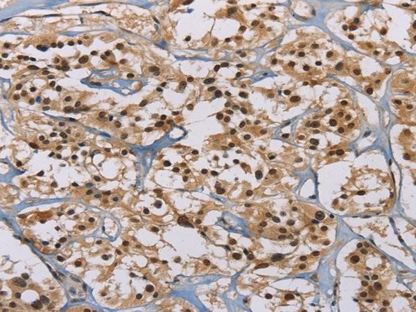 Anti-Activin Receptor Type IA Rabbit Polyclonal Antibody