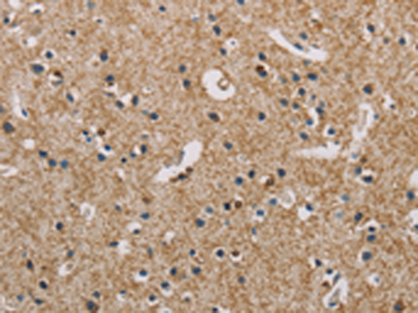 Anti-PIP4K2A Rabbit Polyclonal Antibody