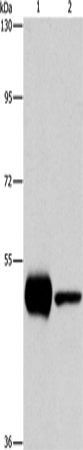 Anti-PIP4K2A Rabbit Polyclonal Antibody